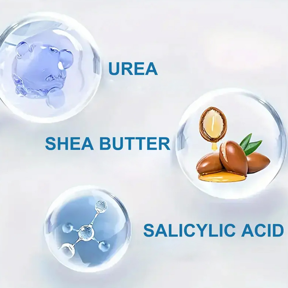 YOUNGCOME 250G Urea Cream with - đánh giá và giá Azelaic Acid Cream