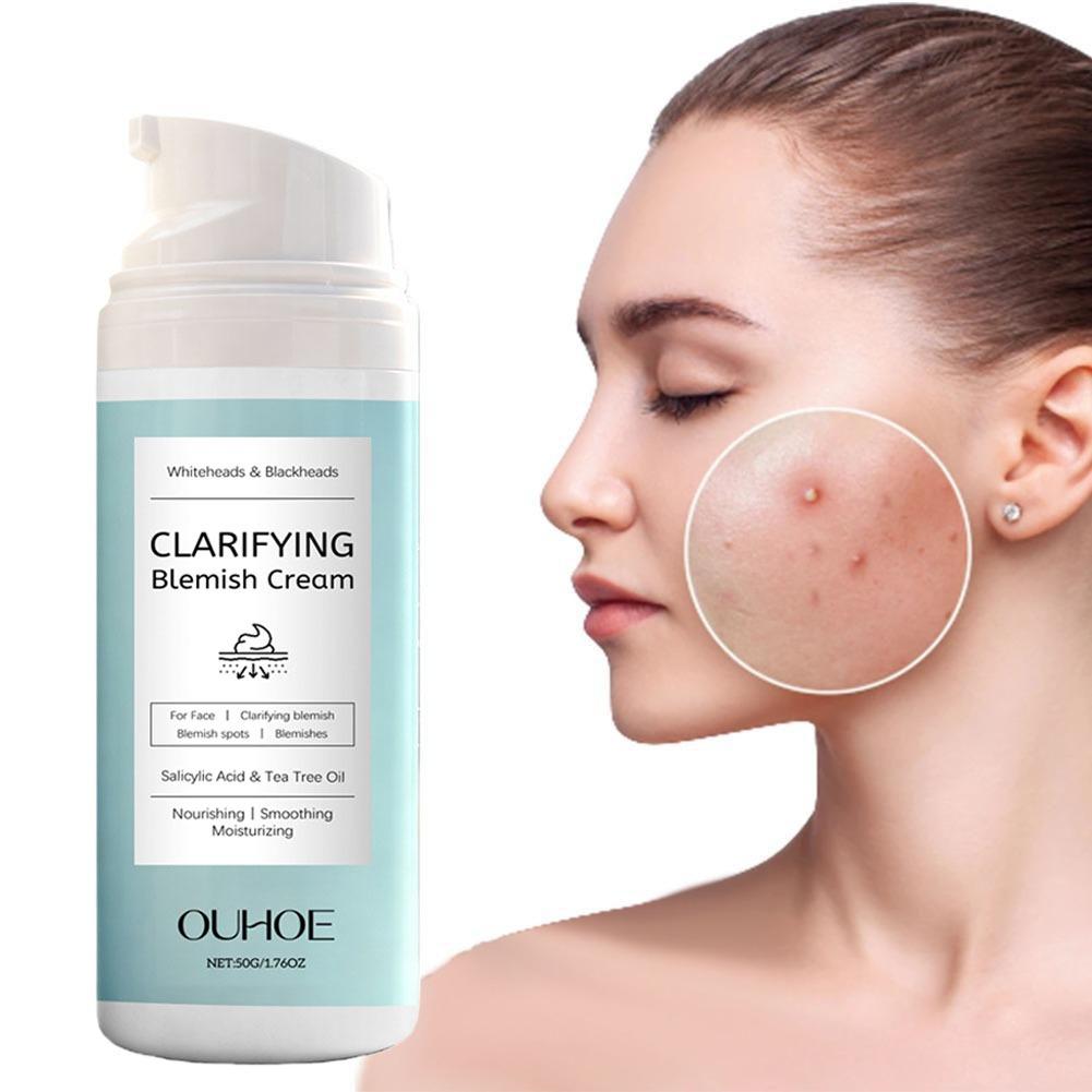 Salicylic Acid Facial Cream fo - đánh giá và giá Azelaic Acid Cream