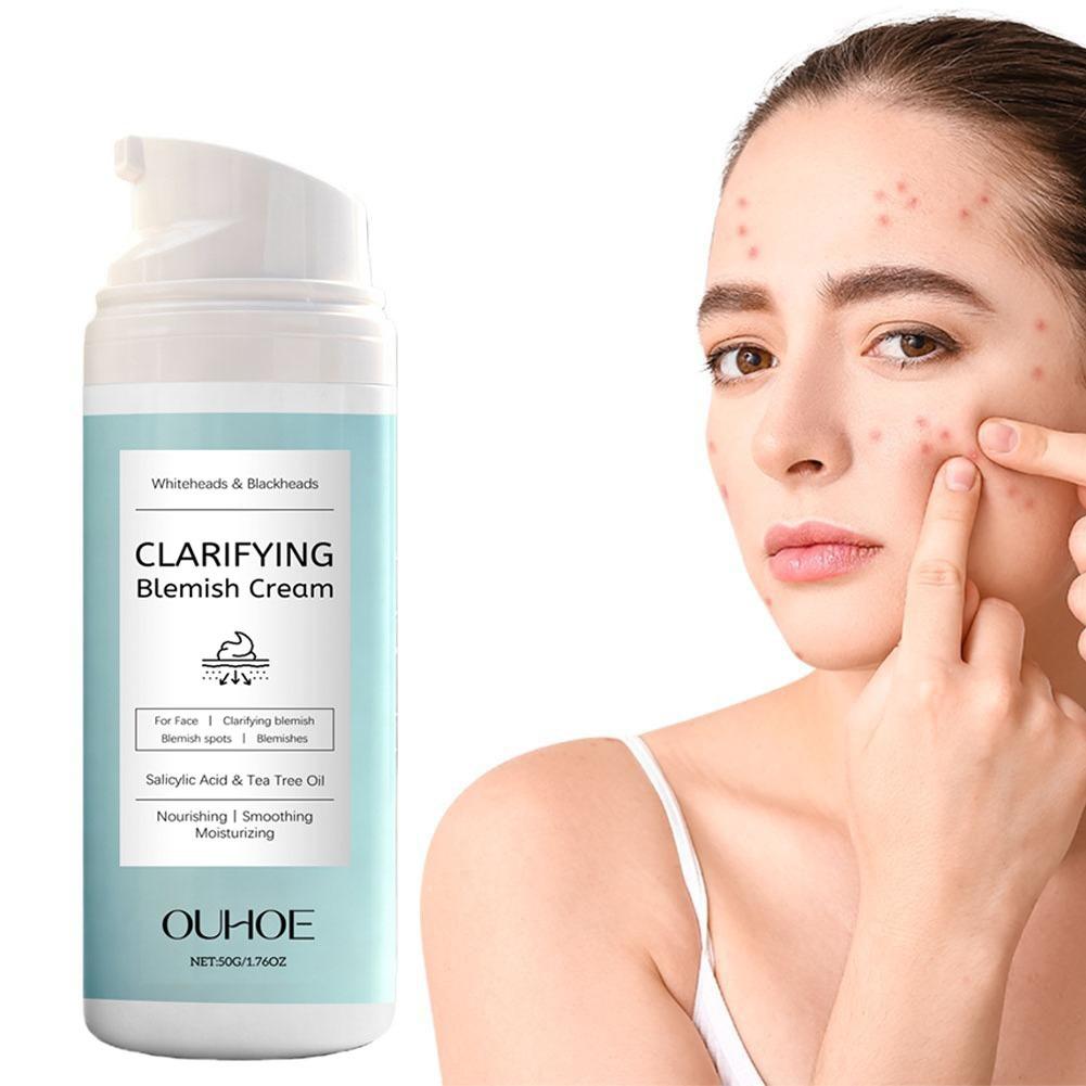 Salicylic Acid Facial Cream fo - đánh giá và giá Azelaic Acid Cream