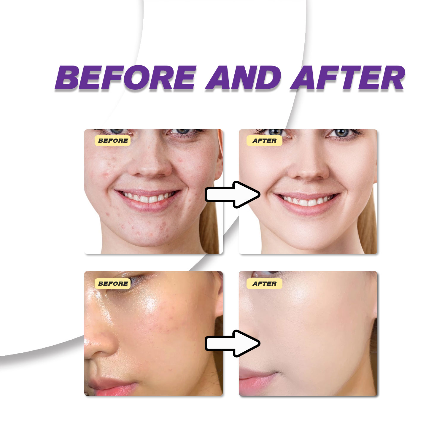 Mild Azelaic Acid Cream Improv - đánh giá và giá Azelaic Acid Cream