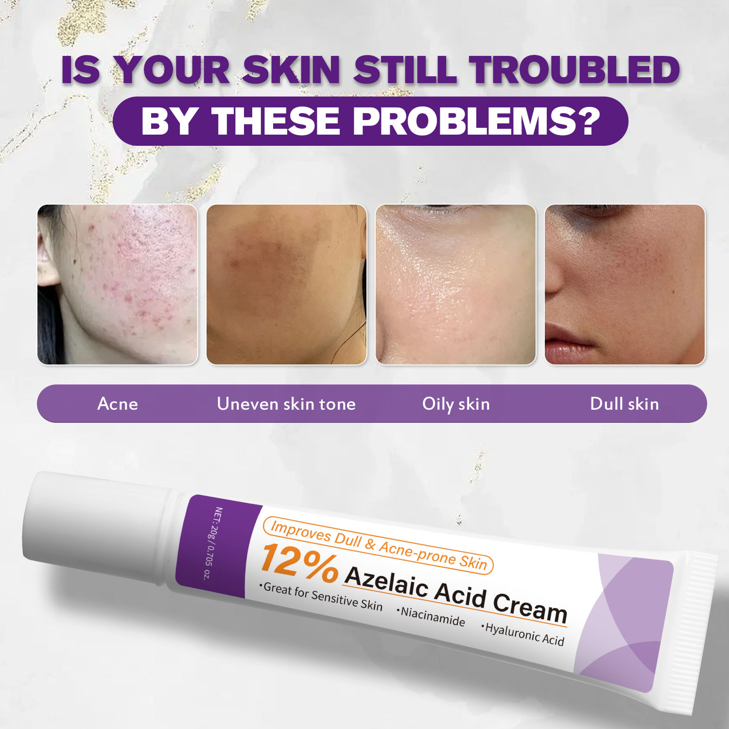 Mild Azelaic Acid Cream Improv - đánh giá và giá Azelaic Acid Cream