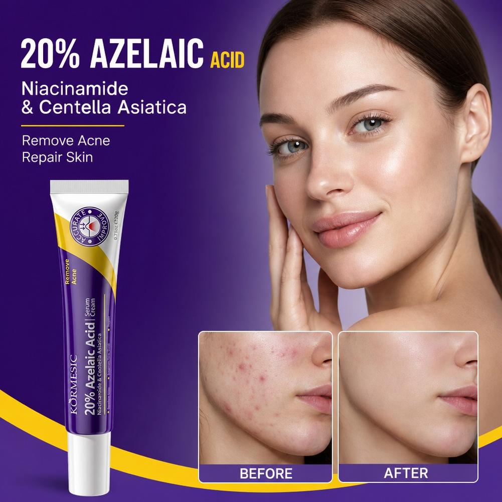 20% Azelaic Acid essence Deep  - đánh giá và giá Azelaic Acid Cream