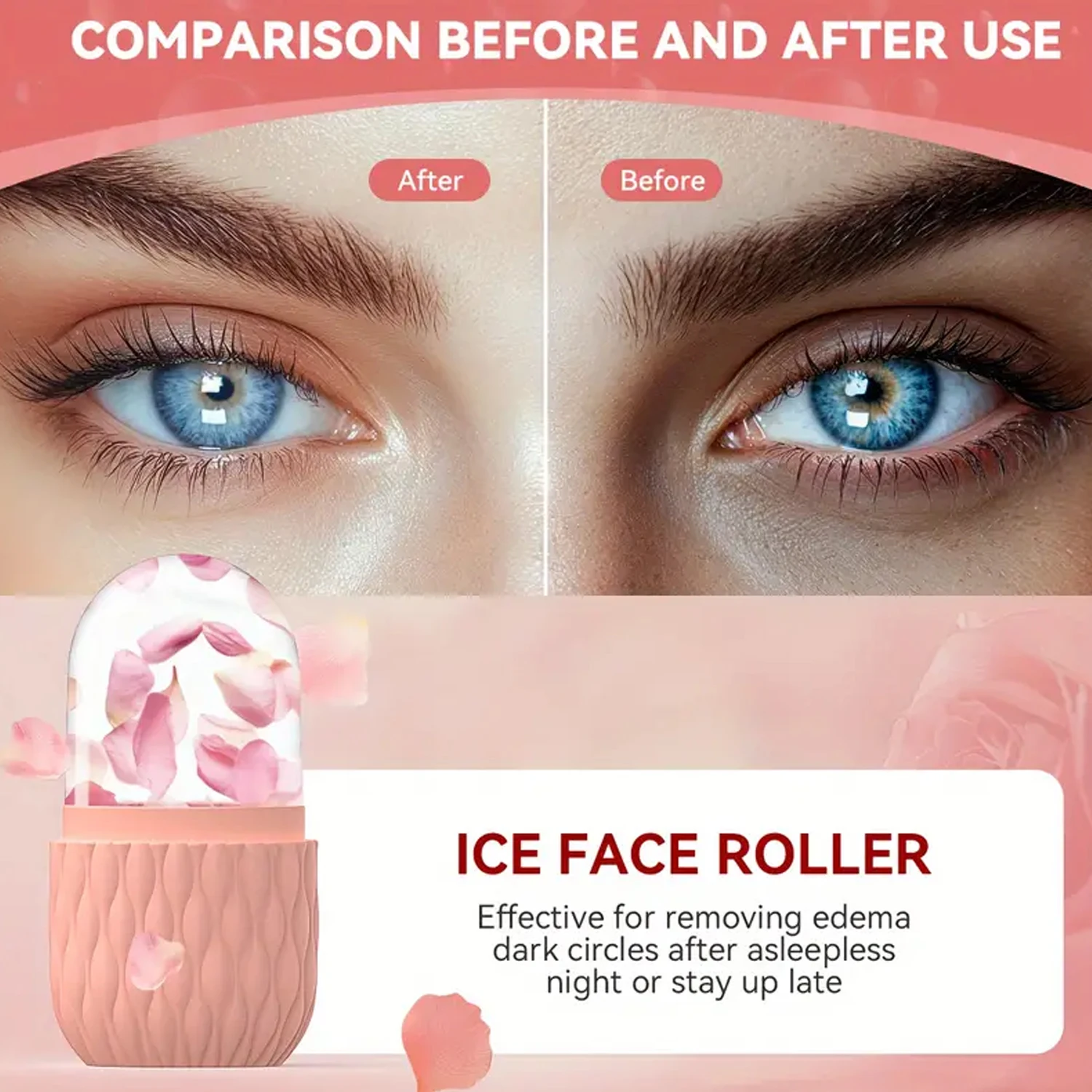 Ice Roller & Stainless Steel G - đánh giá và giá Skincare Glowing